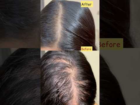 Rosemary Water Spray for hair growth #rosemary #hairspray #hairgrowth #ytshorts