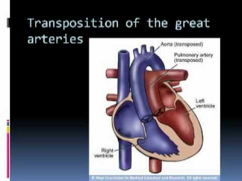 Palliative Didactic:  Pediatric Overview - Pt 3