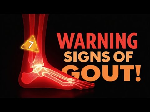 7 warning signs of gout – check before it’s too late!