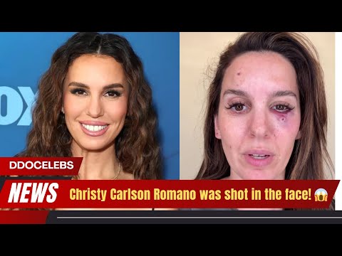 Christy Carlson Romano Shot in the Face—Her Update!