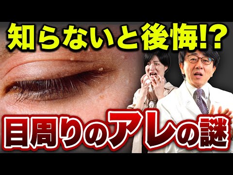 目の周りのデキモノ！眼科医が原因と治療についてお話します。