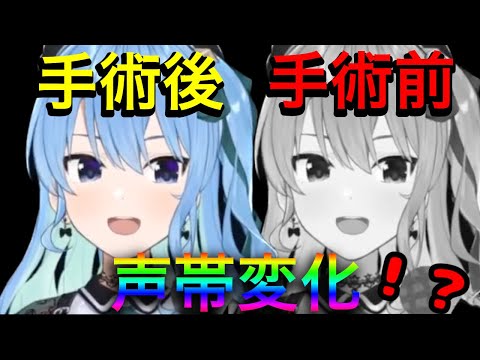 待望のすいちゃん復活ッ！気になる手術後の声帯変化とは！？【星街すいせい/ホロライブ切り抜き】