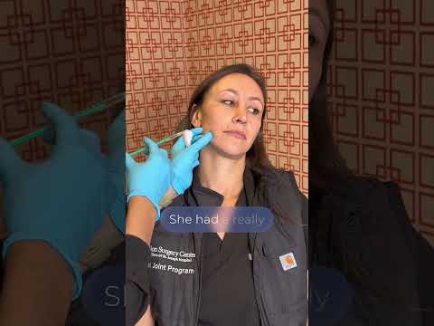 Benefits of Masseter Botox for Jaw Slimming & TMJ Relief | Stoker Plastic Surgery