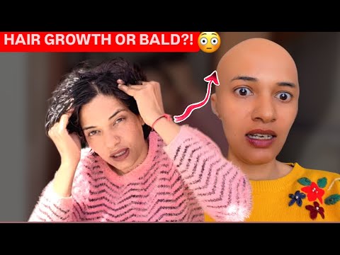 I Oiled My Hair for Growth… But Ended Up Bald! | अमोहा Vlogs