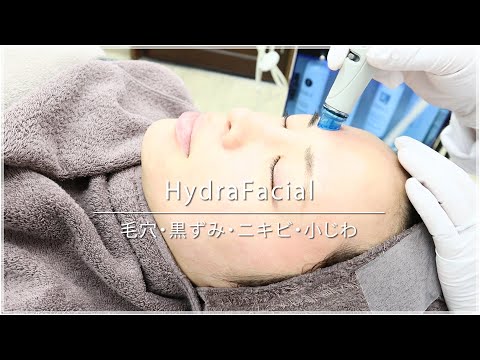 【黒ずみ・ニキビ】水流を使用したピーリング「ハイドラフェイシャル」の治療風景【HydraFacial】