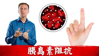 胰島素5.修復胰島素阻抗,自然療法,柏格醫生 Dr Berg