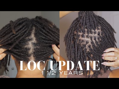 1 1/2 Year Loc Update | Answering Questions| Hot Oil Treatment