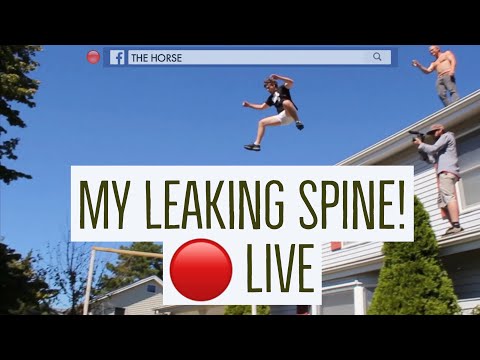 🔴 Facebook LIVE! My spine is leaking!