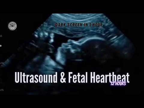 Ultrasound and Fetal Heartbeat ⨀ Soothing Sleep Sounds for Relaxation and Comfort