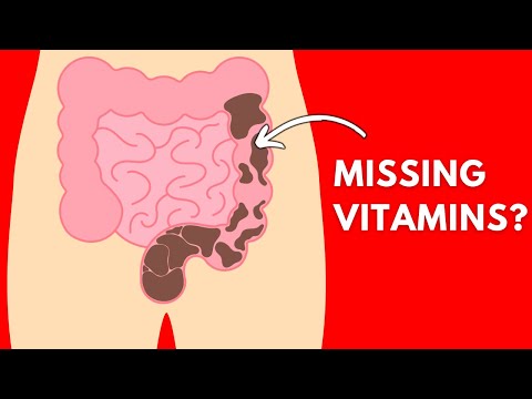 Fix constipation with 2 nutrients - it’s not what you think!