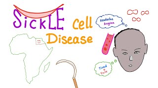 Sickle Cell Disease “Part 1” Intro