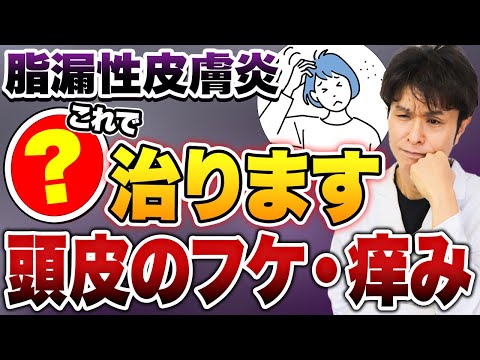 頭のフケやかゆみ、それは病気のサイン？！脂漏性皮膚炎の原因と効果的な治療法