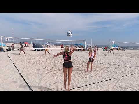 p1440 Futures Tour: Gulf Shores AL, Feb 25-26 - Round 2 - Forester/Stenzel vs Bryant/Schrock - Set 2