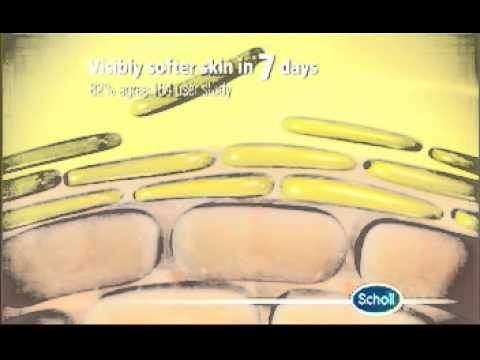 Scholl Hard Skin Cream and Remover TV advert