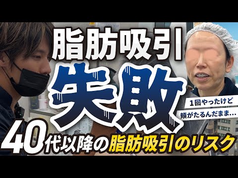 【脂肪吸引の修正手術】「1回やったけど口元が弛んだまま...」45歳女性の脂肪吸引失敗例から学ぶ、40代以降の脂肪吸引リスクとたるみ対策【40代以降の脂肪吸引】