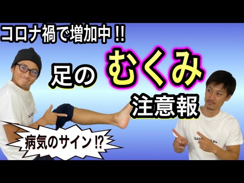 【若年者で増加中】病気のサイン⁉︎侮るなかれ足のむくみ（浮腫）