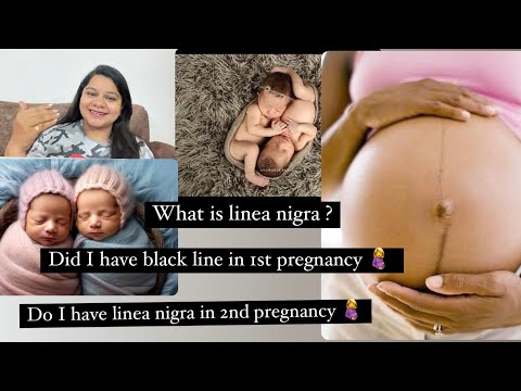 Do I have linea nigra now 🤰? #lineanigra #pregnancy #pregnancytips #pregnant #genderpredictions #boy