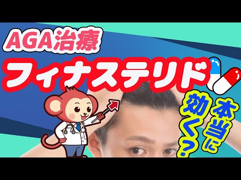 【AGA治療】フィナステリドの実際の効能やメリット&デメリット【医師監修で解説】