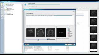 Part 1, OnDemand 3D CBCT software, Importing DICOM Data set, By Dr. Khaled Ekram (in English)