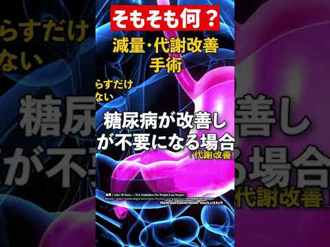 【手術】NEWS、アジア人はBMI 27.5からの推奨も、31年ぶり減量・代謝改善手術のガイドライン【健康】 #shorts