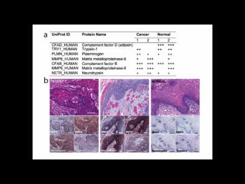 The Neurobiology of Cancer Pain, Palliation and Survival