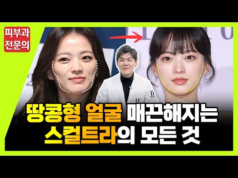 스컬트라 부작용?효과? 1만번 시술해본 피부과 전문의가 확실하게 말씀드립니다.