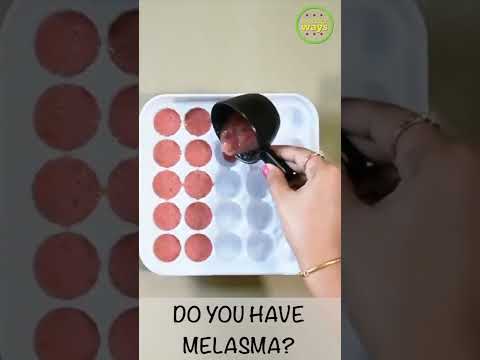 Home remedy for Hypertension #melasma #hyperpigmentation #homeremedy #ytshorts