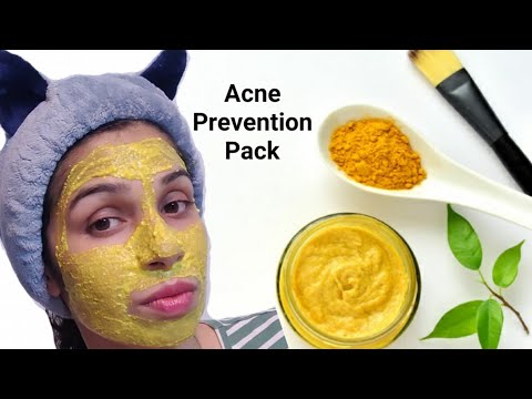 Acne & Pimples Prevention Mask | DIY How to get rid of Acne | Natural Beauty Tips | Home Remedies