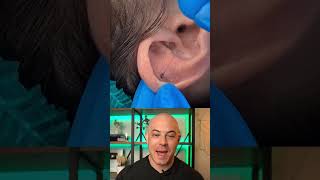 Derm reacts to a HAIRY situation! #dermreacts #doctorreacts #piercing