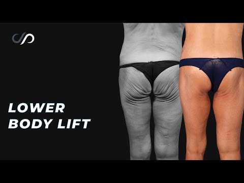 Say Goodbye to Sagging Skin with THIS Toned Lower Body Secret!