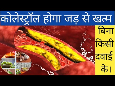 कोलेस्ट्रॉल होगा जड़ से ख़त्म बिना किसी दवाई के | Reduce Cholesterol Naturally with these 6 Herbs