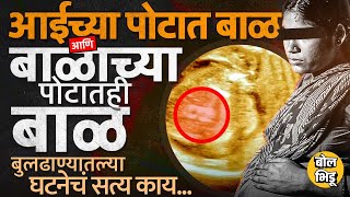 Buldhana मध्ये गर्भवती महिलेच्या पोटात बाळ आणि बाळाच्या पोटात आणखी १ बाळ, Fetus in Fetu Case आहे काय