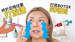 💉第一次醫美失敗經歷 | 公開打過針劑項目 | 水光槍vs水光針 | 打botox 瘦面咀嚼肌 | 填充淚溝 | ￼嘴唇filler