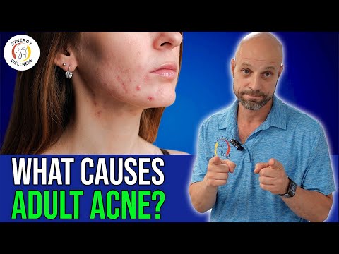 What's REALLY Causing Your Adult Acne? | Leaky Gut Syndrome