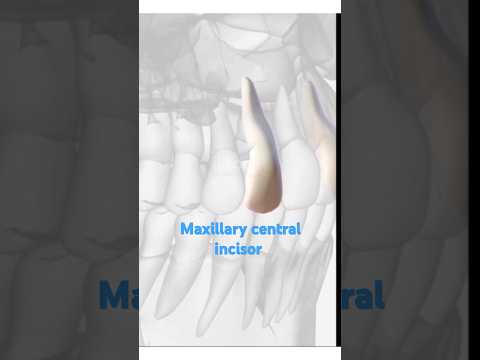 Maxillary Central Incisor morphology in 30 seconds