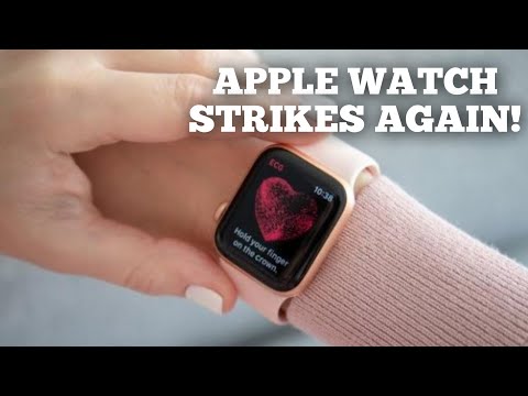 Apple Watch Saves ANOTHER life!!!