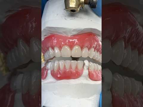 Try-In Bite #lsk121shorts #dentist #teeth