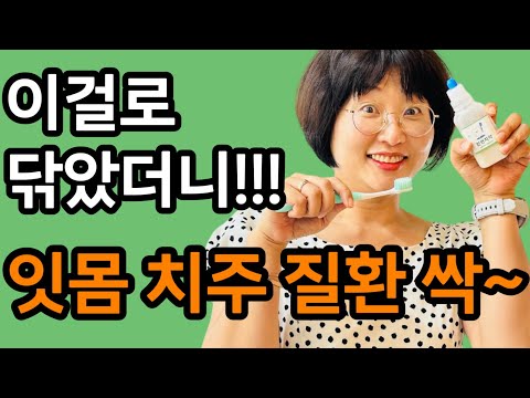 이걸로 닦았더니!!! 잇몸 치주 질환, 시린 이 증상이 싹 사라졌어요!!!