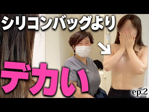 柔らかくて自然でシリコンバッグのサイズ超え！30代脂肪豊胸で夢の細巨乳に！ ep2｜美ボディラインch#227