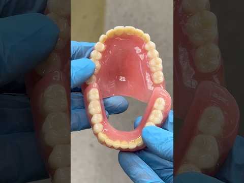 Fantastic Immediate Dentures #teeth #dentist #lsk121shorts