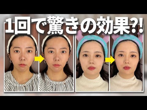 【脱マスクに救世主】フェイスラインを美しくする、ミュゼ史上最強の美容液とは！？