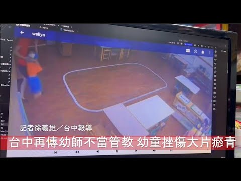 台中再傳幼師不當管教 幼童挫傷大片瘀青