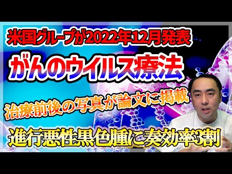 【がん】2022年12月に米国からがんのウイルス療法の注目される論文発表、免疫チェックポイント阻害薬を併用した治療の結果【論文、悪性黒色腫、メラノーマ、医療、健康】