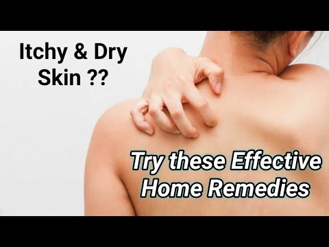 Home Remedies for Itchy Skin| Quick cure for Itching skin |How to Relieve Dry & Itchy skin naturally