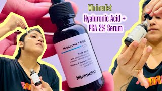 Minimalist Hyaluronic Acid Serum 2% Review and How to use ✨NON SPONSORED Review