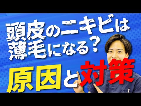 【AGA・薄毛予防】頭皮にたまにできるニキビって薄毛の原因？対策はあるの？