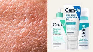 Top 5 CeraVe Skincare for Oily + Combination Skin Types