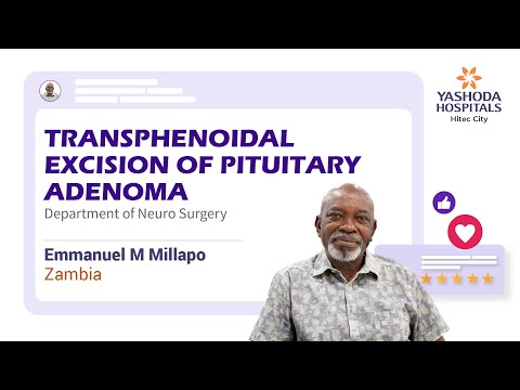 Transphenoidal Excision of Pituitary Adenoma | Treatment for Pituitary Adenoma |