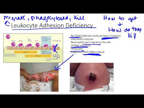 Immunodeficiencies of the Innate Immune Response