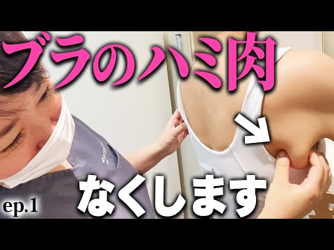 全女性が気になる老け見えハミ肉！脂肪吸引で生まれ変わる背中美人！ep1｜美ボディラインch#261